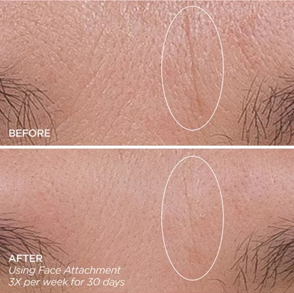 Beauty Bio Microneedle, Zen Bubble Moisturizer, & The Balance Cleanser Set - Picture 8 of 15